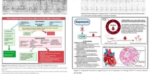 Peer-Reviewed Study: Resolution of Refractory COVID-19 Vaccine-Induced Myopericarditis with Adjunctive Rapamycin